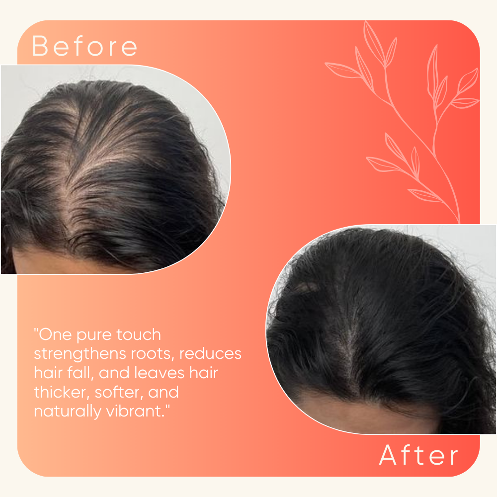 Wood Pressed hibiscus & Shikaka Hair Fall Control Oil – 100 ml