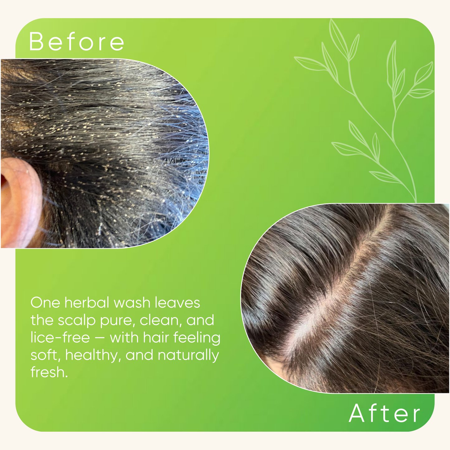 Neem & Tulsi ANTI-LICE & NITS Shampoo With Steel Lice & Nits Removal Comb