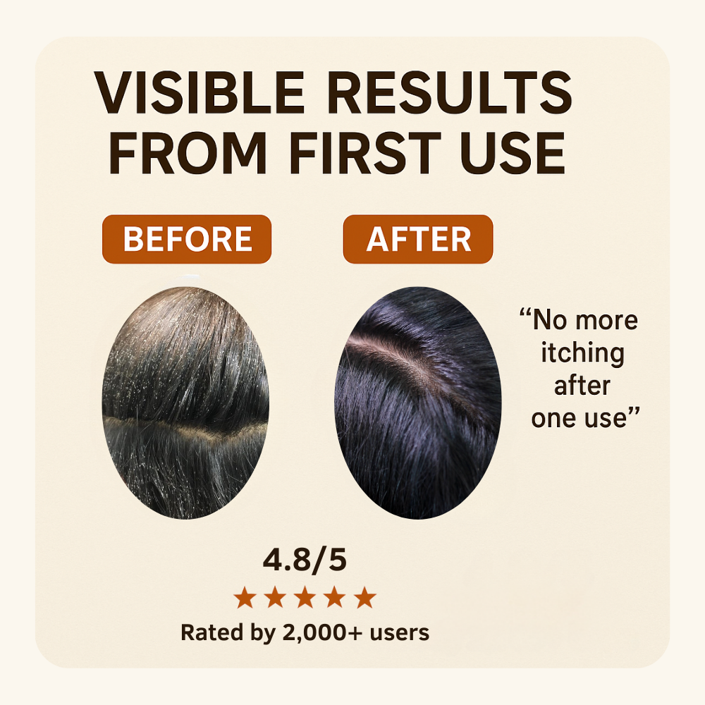 Gangaa Naturals Steel Premium Lice & Nits Removal Comb